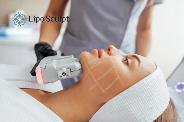 HIFU vs Botulinum Toxin: Understanding the Differences 1 HIFU vs Botox Kilmarnock What is the best option for you?