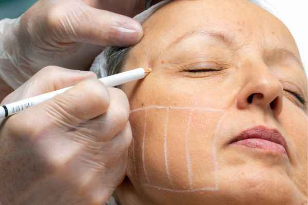 CryoPen: 5 Skin Concerns It May Be Used to Treat 4 What should you ask before having CryoPen treatment Kilmarnock?